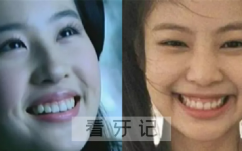 露龈笑是什么样的附照片