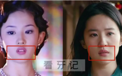 厚唇是什么样的附照片