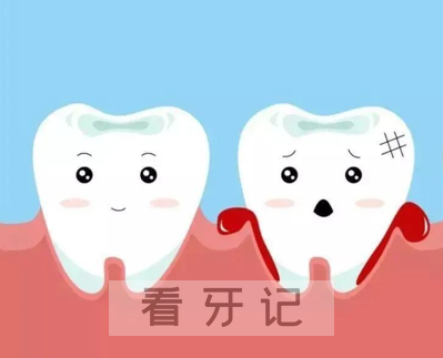 牙周病的典型症状和治疗方法