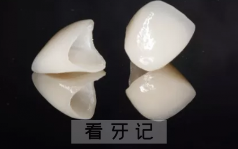 全瓷牙一般能用多少年的寿命