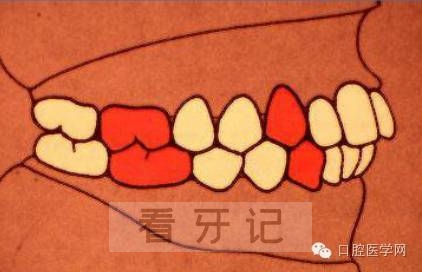 安氏分类法图片图示