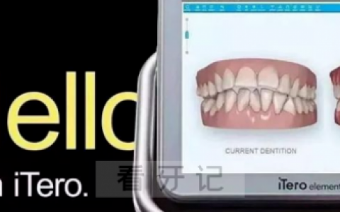 iTero口扫仪是什么