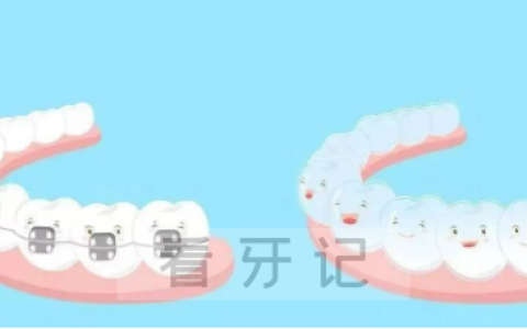 北京的口腔医院牙齿矫正一般要花费多少钱
