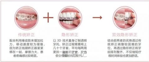 什么是双效牙齿矫正