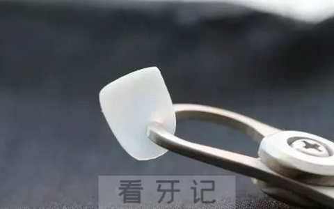 陶瓷贴面和树脂贴面哪个更好