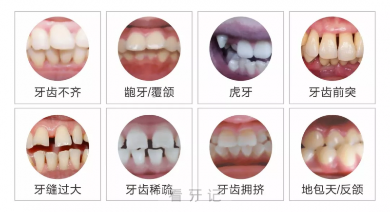 黑脸不打烊网友科普：牙齿不好是缺什么营养成分？