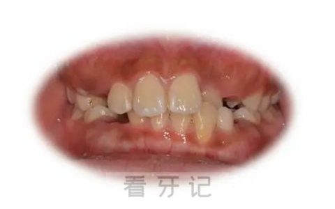 **看牙记