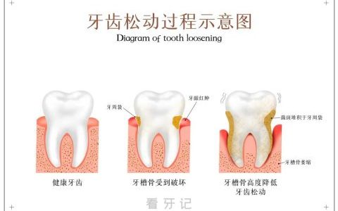什么才是真正健康的牙齿附牙齿健康标准