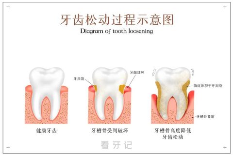 什么才是真正健康的牙齿附牙齿健康标准