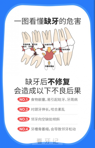 穗华口腔医院科普缺牙危害