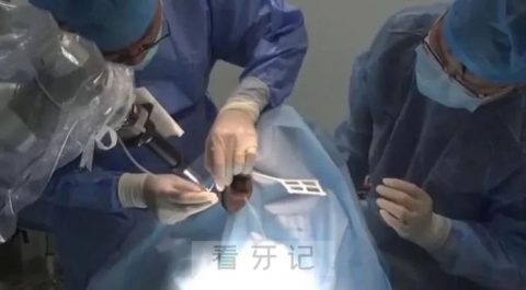 苏大附一院口腔科完成苏州首例机器人口腔种植手术