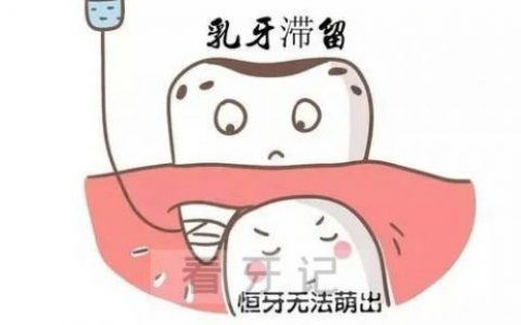 上海中博口腔医院科普乳牙滞留拔除