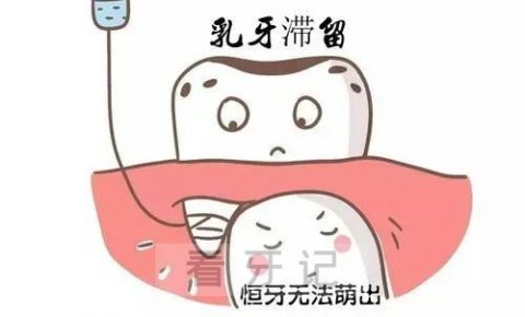 上海中博口腔医院科普乳牙滞留拔除