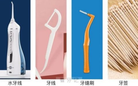 成都曼斯特口腔正畸托槽科普