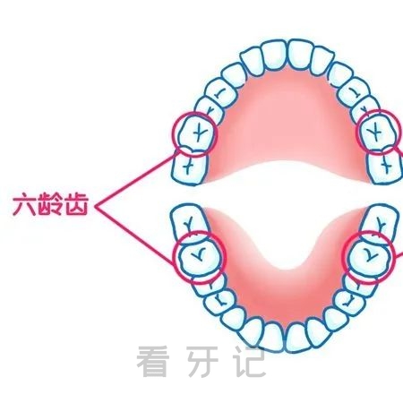 六龄牙具体位置图示