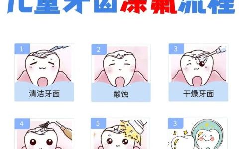 儿童牙齿涂氟流程图示