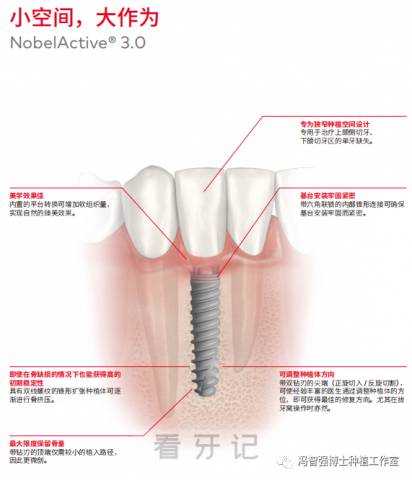 NobelActive 种植体（直径3.0窄植体）介绍