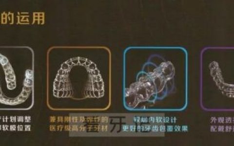 金华口腔医院引进易而戴双膜无附件隐形矫正系统