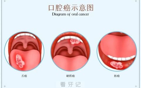 青岛**口腔黏膜科王彩霞看牙记