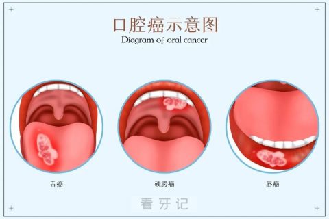 青岛市口腔医院口腔黏膜科王彩霞看牙记