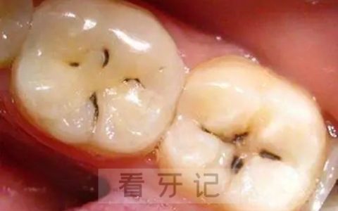牙齿黑线黑色线条图片