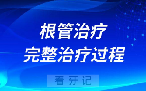 根管治疗完整治疗过程步骤最新整理
