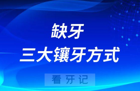 缺牙三大镶牙方式