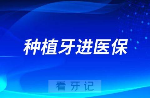 种植牙可不可以进医保