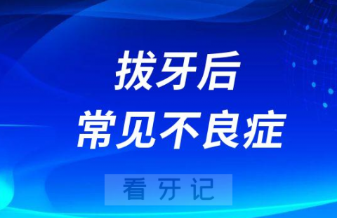 拔牙后常见不良症状整理