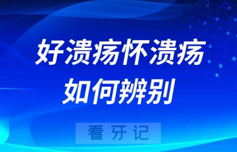 怎么辨别嘴巴溃疡是不是恶性癌性溃疡