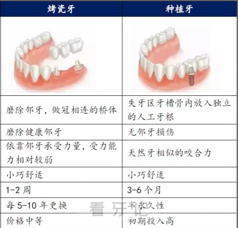烤瓷牙和种植牙到底哪个更好如何选择