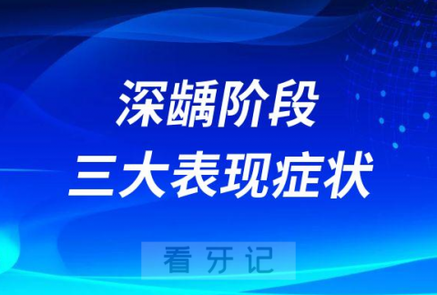 龋齿深龋阶段三大表现症状