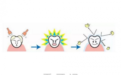 涂氟危害是否会造成氟斑牙