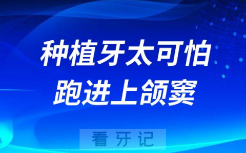 种植牙太可怕太吓人了竟然“跑”进上颌窦可能会引起颅内感染