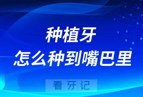 种植牙是怎么种到嘴巴里的