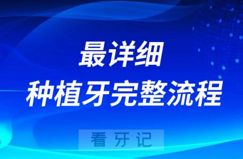 最详细的种植牙完整流程附最新种植牙价格表2022-2023