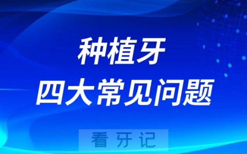 种植牙四大常见问题排行榜