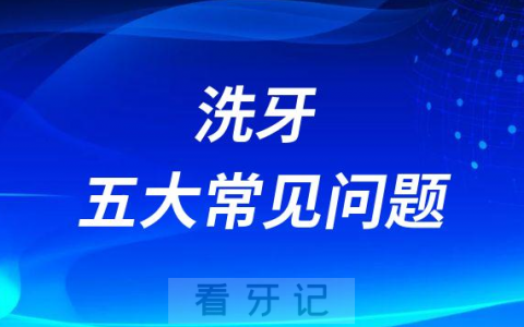 洗牙五大常见问题排行榜