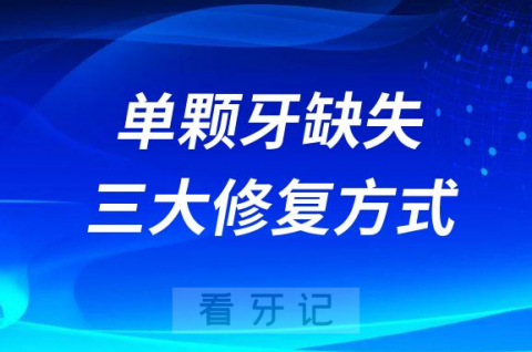 单颗牙齿缺失三大修复方式