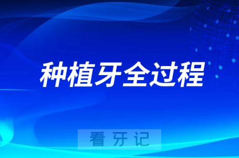 种植牙全过程附七大步骤