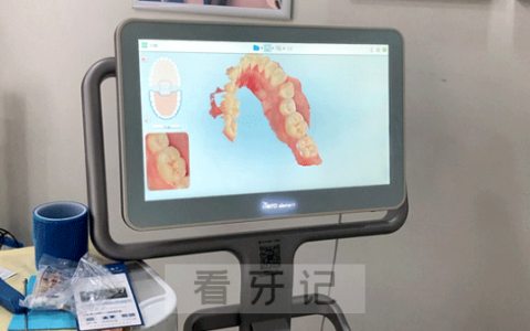 itero口扫有没有辐射