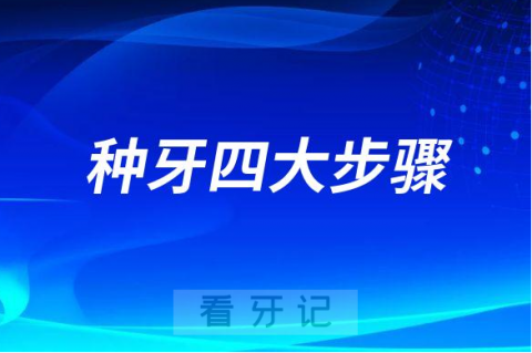 种牙四大步骤整理不要再害怕种牙了