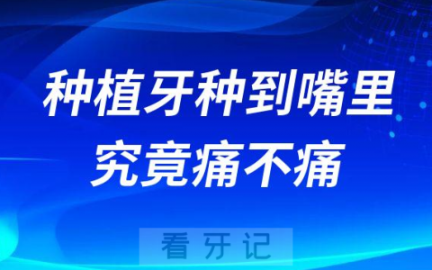 种植牙太吓人了种植牙怎么种到嘴里究竟痛不痛