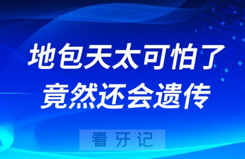 “地包天”太可怕了竟然还会遗传后悔没早治疗