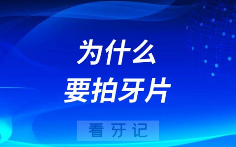 医生让拍牙片为什么要拍牙片附十大重要性