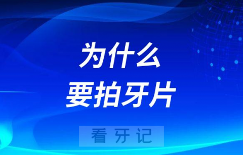 医生让拍牙片为什么要拍牙片附十大重要性