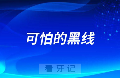 可怕的黑线！牙齿出现黑线是不是就说明已经蛀牙了