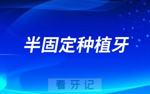 半固定种植牙全固定种植牙三大区别