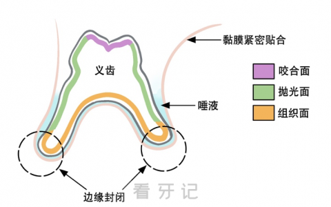 什么是吸附性义齿附真实图片