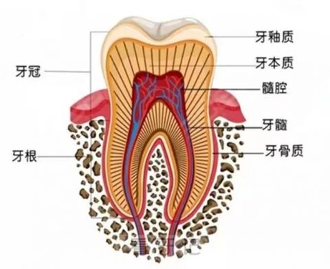 蛀牙龋齿一定要做根管治疗吗